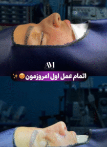 نمونه عمل بینی دکتر افسانه محمدپور مالکی