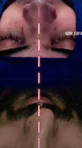 نمونه عمل بینی دکتر داریوش عرفانیان