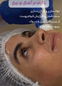 نمونه آر اف فرکشنال کلینیک نوآوران زیبایی