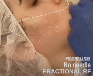 نمونه آر اف فرکشنال کلینیک نوآوران زیبایی