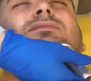 نمونه آر اف فرکشنال کلینیک نوآوران زیبایی