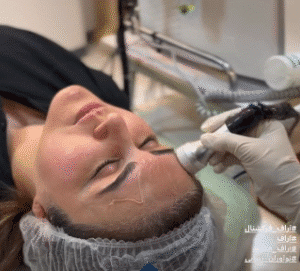 نمونه آر اف فرکشنال کلینیک نوآوران زیبایی