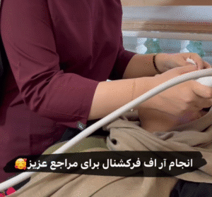 نمونه آر اف فرکشنال صورت دکتر فرشته طاهر
