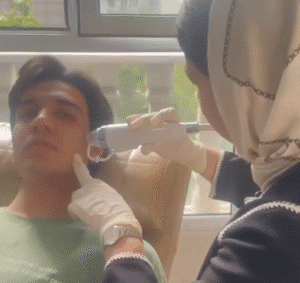 نمونه آر اف فرکشنال صورت دکتر فرشته طاهر