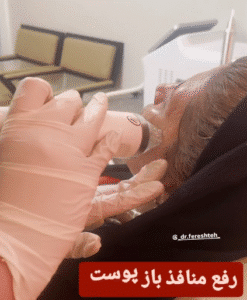 نمونه آر اف فرکشنال صورت دکتر فرشته طاهر