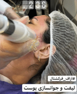 نمونه آر اف کلینیک زیبایی دلوین