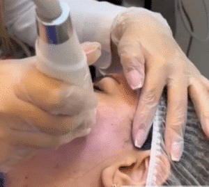 نمونه آر اف کلینیک زیبایی دلوین