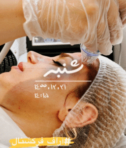 نمونه آر اف کلینیک زیبایی دلوین