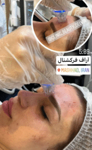 نمونه آر اف کلینیک زیبایی دلوین