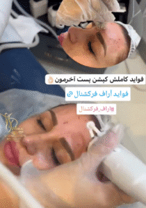 نمونه آر اف کلینیک زیبایی دلوین