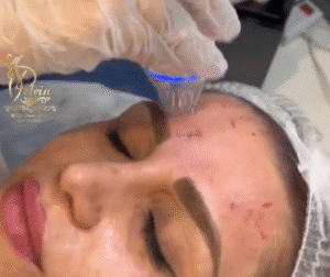 نمونه آر اف کلینیک زیبایی دلوین