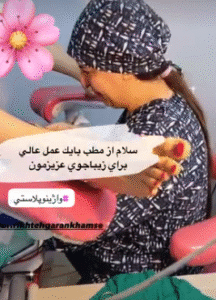 لابیاپلاستی دکتر انسیه ریخته گران خمسه