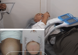 نمونه لاغری موضعی دپارتمان لاغری مانا