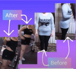 نمونه لاغری موضعی دپارتمان لاغری مانا