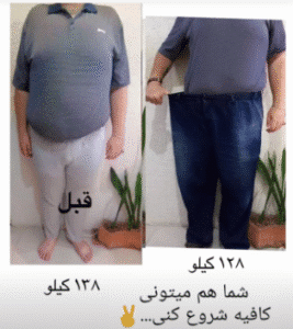 نمونه لاغری موضعی دپارتمان لاغری مانا