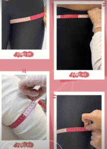 نمونه لاغری کلینیک زیبایی گلدن رویال