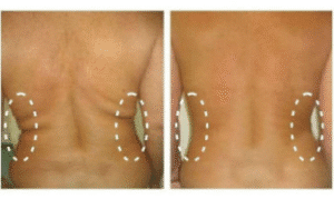 نمونه لاغری کلینیک زیبایی گلدن رویال