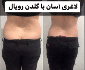 نمونه لاغری کلینیک زیبایی گلدن رویال