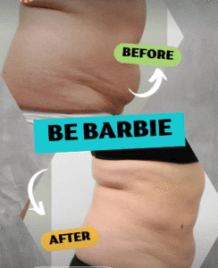 نمونه لاغری کلینیک زیبایی گلدن رویال