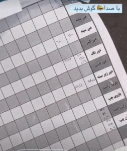 نمونه لاغری کلینیک زیبایی گلدن رویال