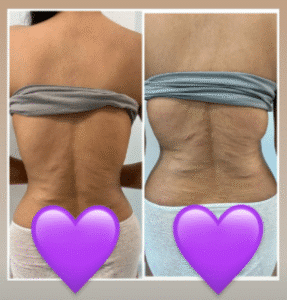 نمونه لاغری کلینیک زیبایی گلدن رویال