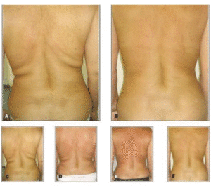 نمونه لاغری کلینیک لاغری مشهد اسلیم