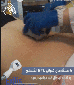 نمونه لاغری کلینیک نوآوران زیبایی