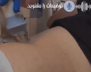نمونه لاغری کلینیک نوآوران زیبایی