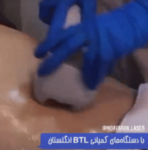 نمونه لاغری کلینیک نوآوران زیبایی