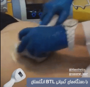 نمونه لاغری کلینیک نوآوران زیبایی