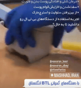 نمونه لاغری کلینیک نوآوران زیبایی