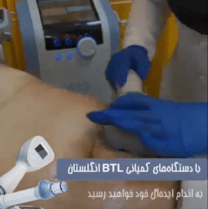 نمونه لاغری کلینیک نوآوران زیبایی