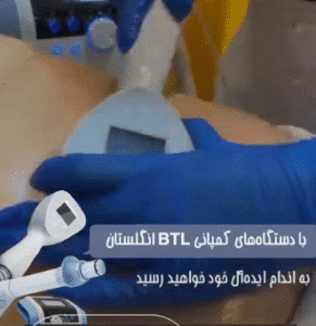 نمونه لاغری کلینیک نوآوران زیبایی