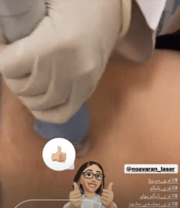 نمونه لاغری کلینیک نوآوران زیبایی