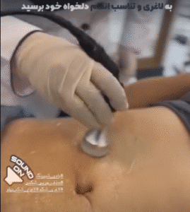 نمونه لاغری کلینیک نوآوران زیبایی