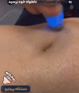 نمونه لاغری کلینیک نوآوران زیبایی