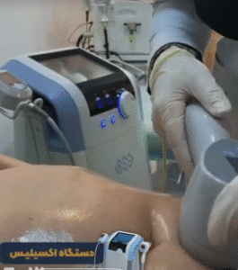 نمونه لاغری کلینیک نوآوران زیبایی