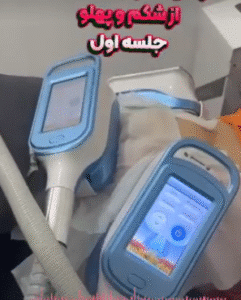 نمونه لاغری مرکز لاغری طراوت