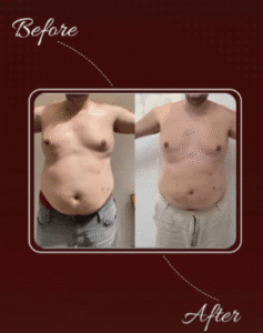 نمونه لاغری مرکز لاغری طراوت