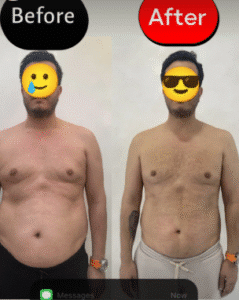 نمونه لاغری مرکز لاغری طراوت