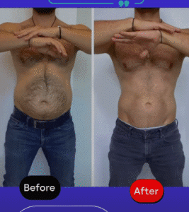 نمونه لاغری مرکز لاغری طراوت