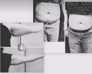 نمونه لاغری مرکز لاغری طراوت