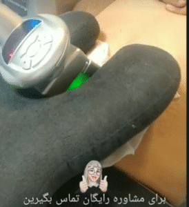 نمونه لاغری مرکز لاغری طراوت