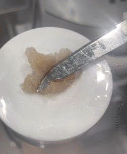 نمونه لاغری کلینیک اکسیر جوانی سایه