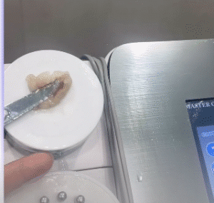 نمونه لاغری کلینیک اکسیر جوانی سایه