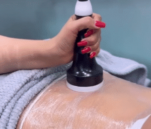 نمونه لاغری کلینیک اکسیر جوانی سایه