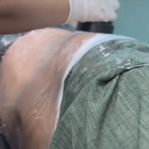 نمونه لاغری کلینیک اکسیر جوانی سایه