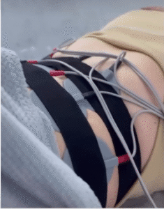 نمونه لاغری کلینیک اکسیر جوانی سایه