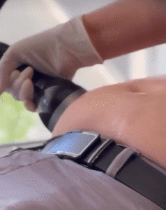 نمونه لاغری کلینیک اکسیر جوانی سایه