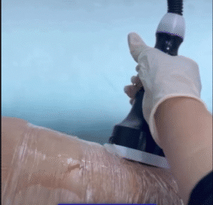 نمونه لاغری کلینیک اکسیر جوانی سایه